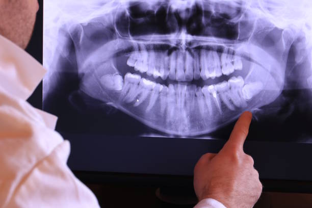 Best Emergency Gum Treatment in Newberry, SC