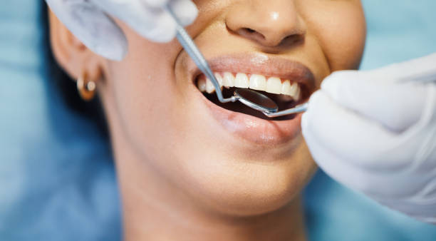 Best Urgent Care for Lost Fillings or Crowns in Newberry, SC
