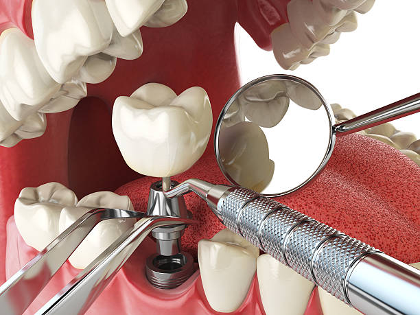 Best Emergency TMJ Treatment in Newberry, SC